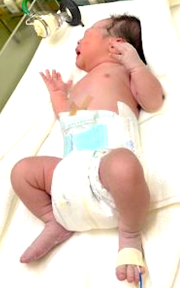 逆子が改善し、40分で出産!妊娠中のケア。 浜松市 34歳 Mさん